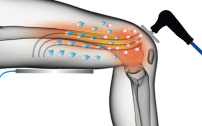 Tecar therapy